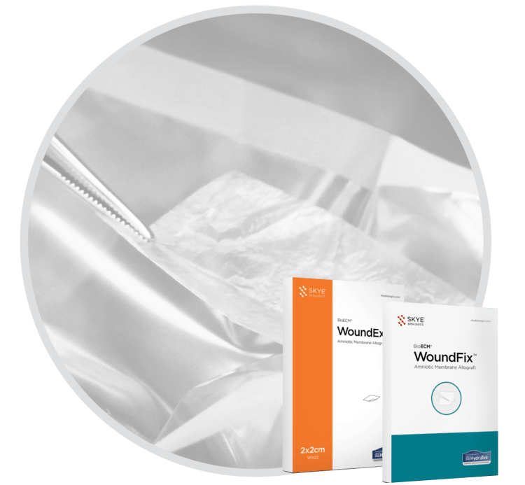 A product image for Skye Biologics WoundEx and WoundFix